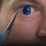 3d Printed Human Cornea For Vision / Eye Surgery